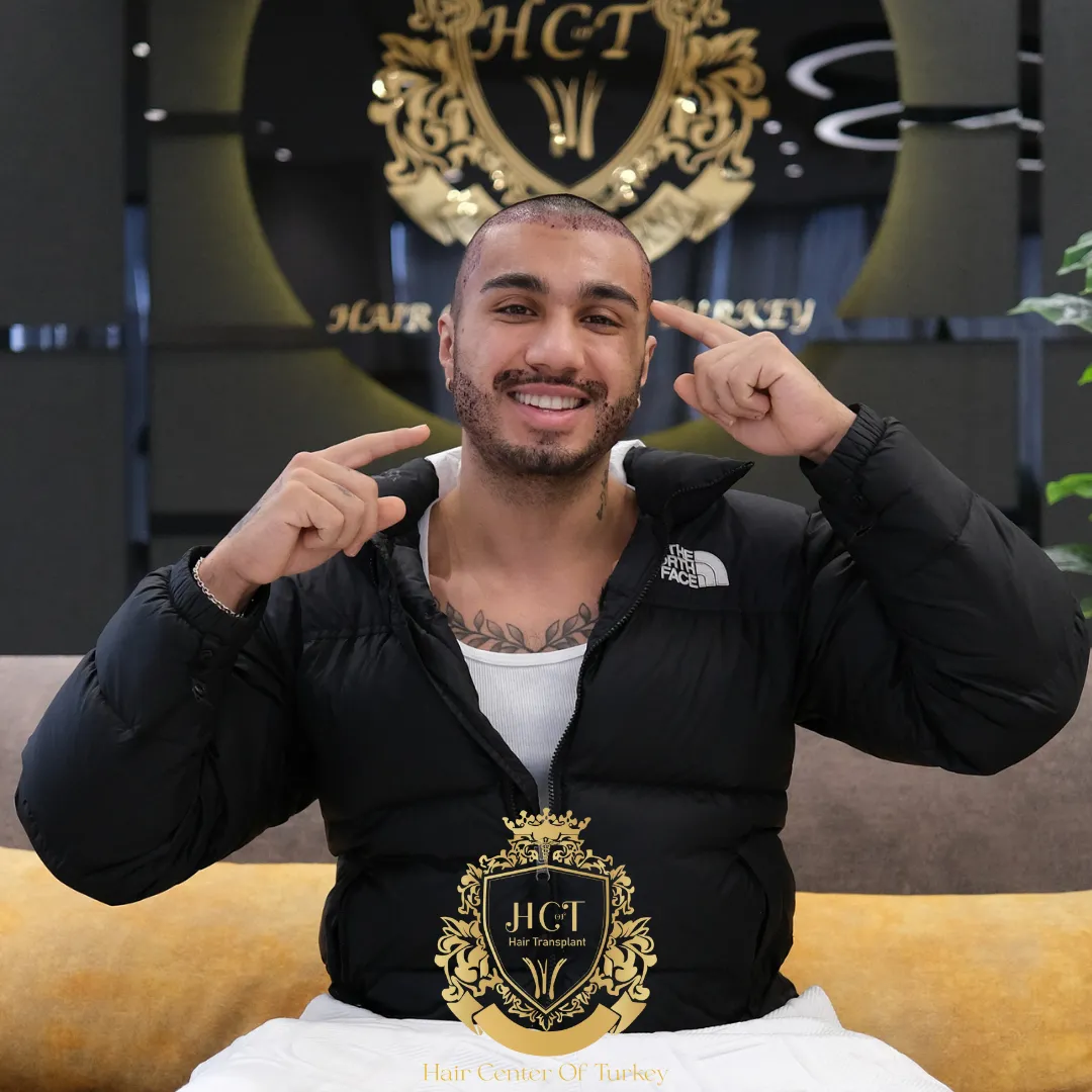 Barttransplantation – Design und Planung für ein harmonisches Gesichtsbild 1 Barttransplantation – Design und Planung