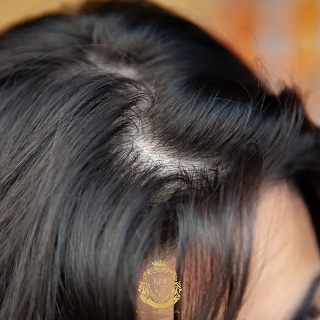 I migliori tagli di capelli per una frangia diradata