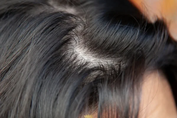 Die besten Haarschnitte für einen dünner werdenden Pony