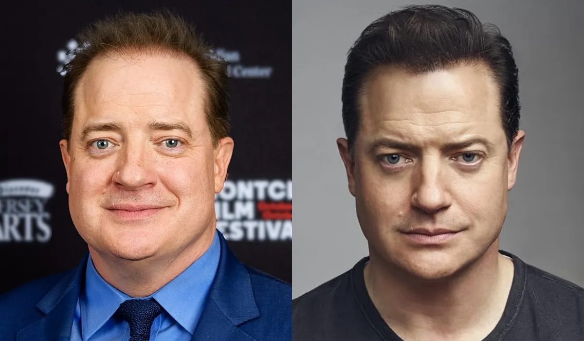 Brendan Fraser Hair Transplant (3) Brendan Fraser Hair Transplant (3)