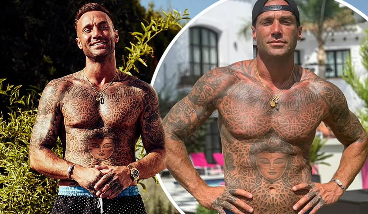 Calum-Beste-Haartransplantatie-2 Calum-Beste-Haartransplantatie-2