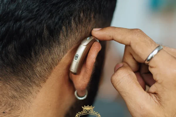 Können Menschen mit Hör- oder Sprachbehinderung eine Haartransplantation durchführen lassen?