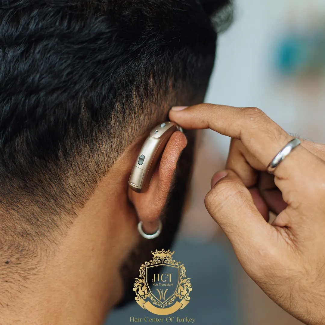 Can People with Hearing or Speech Disabilities Get a Hair Transplant? 1 Can People with Hearing or Speech Disabilities Get a Hair Transplant 4