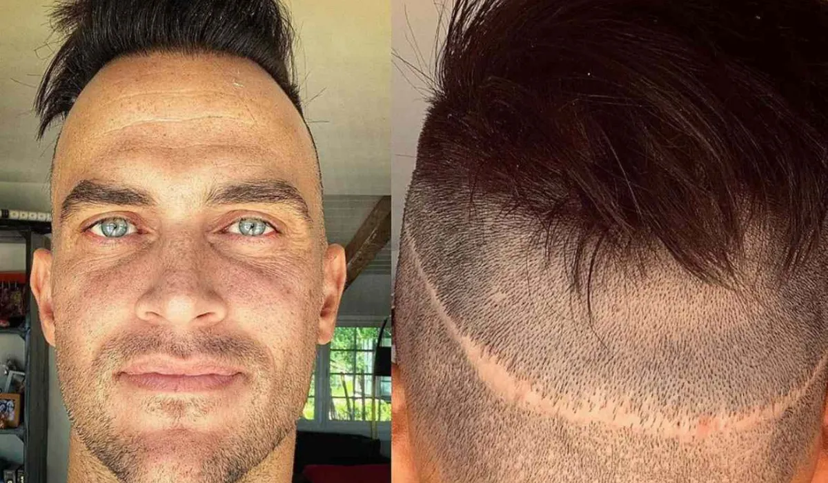 Cheyenne-Jackson-Haartransplantatie-3 Cheyenne-Jackson-Haartransplantatie-3