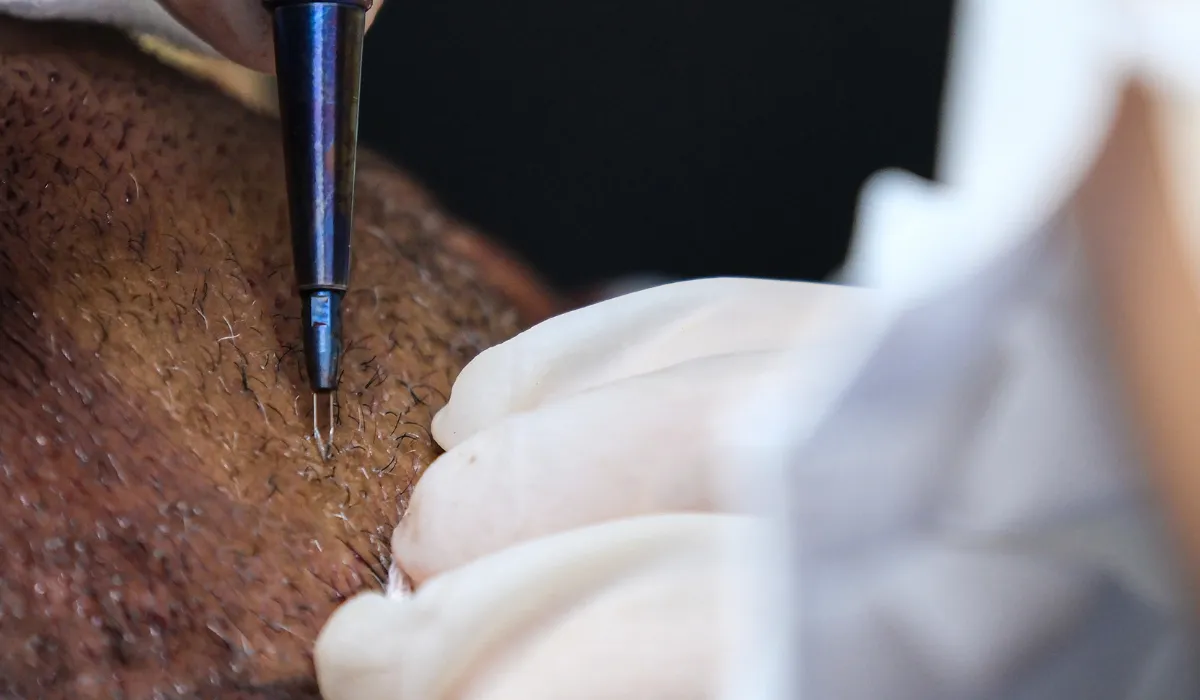 Cheyenne-Jackson-Haartransplantatie-6 Cheyenne-Jackson-Haartransplantatie-6