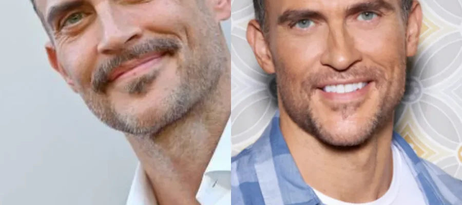 Cheyenne Jackson Hair Transplant