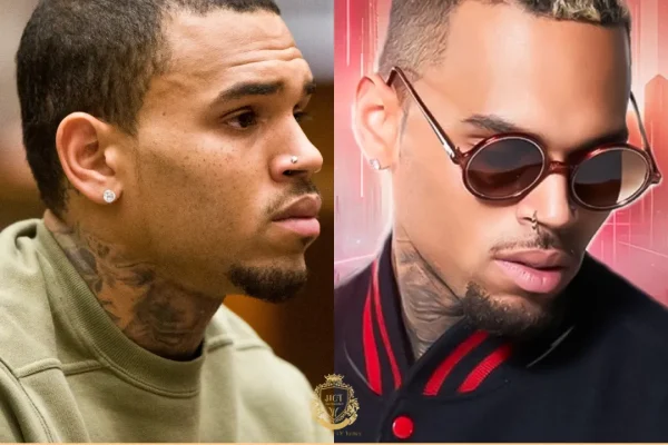 Chris Brown Haartransplantation