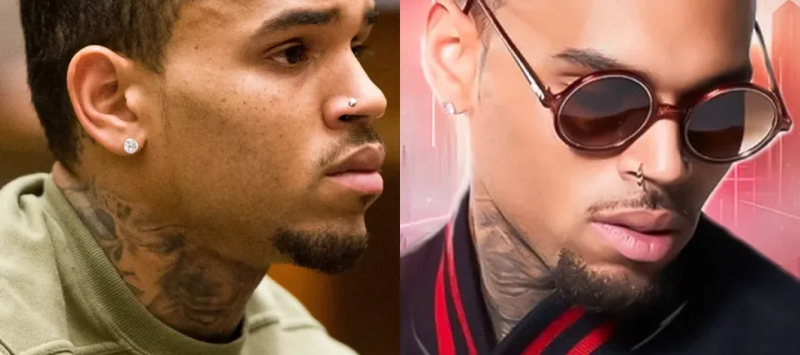 Greffe de cheveux de Chris Brown