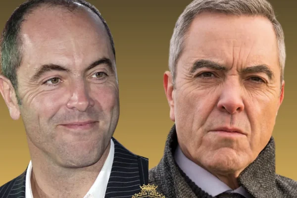 James Nesbitt a-t-il subi une greffe de cheveux ?