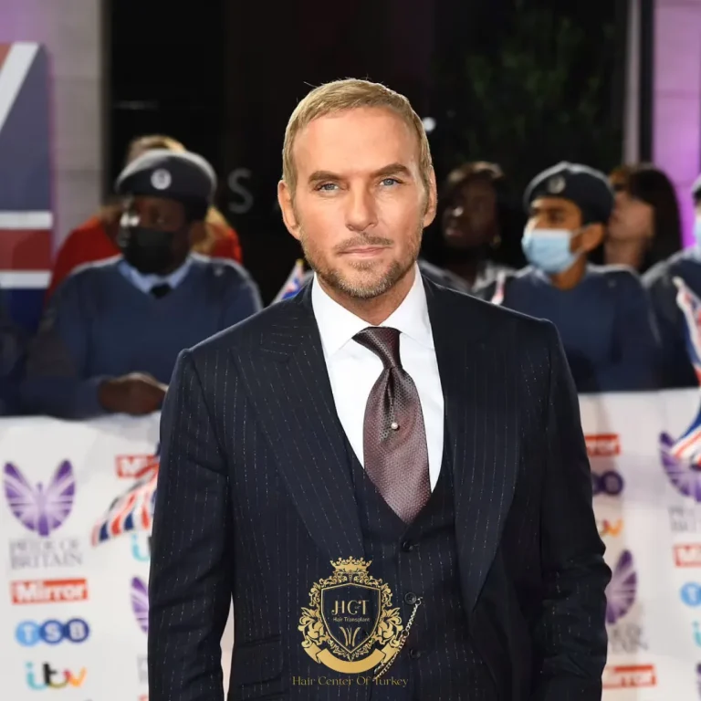 Matt Goss ha fatto un trapianto di capelli?