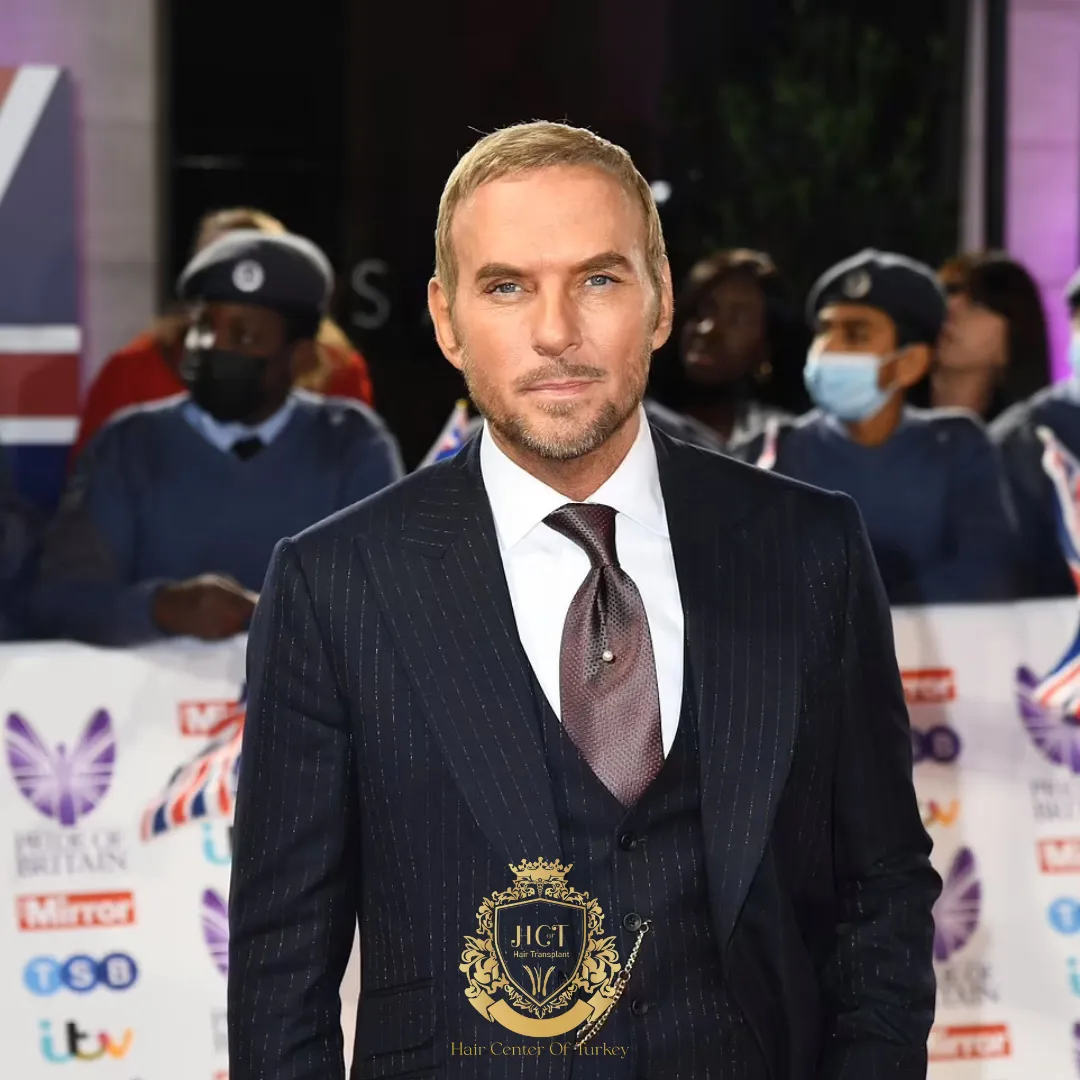 Did Matt Goss Have a Hair Transplant F