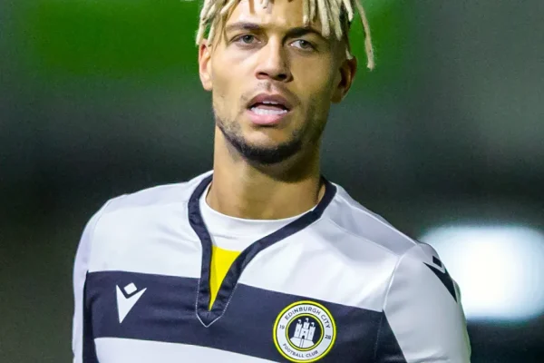 Hat Ouzy sich einer Haartransplantation unterzogen? Hier ist, was wir wissen.