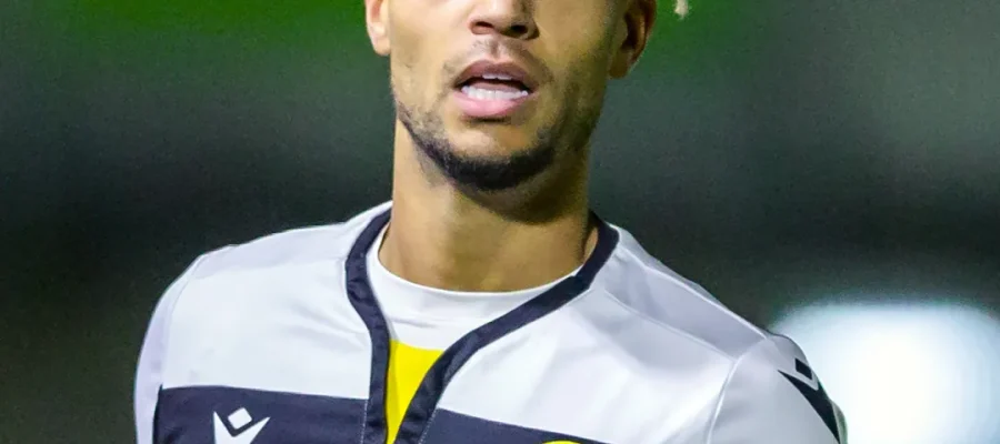 Did Ouzy See Get a Hair Transplant F