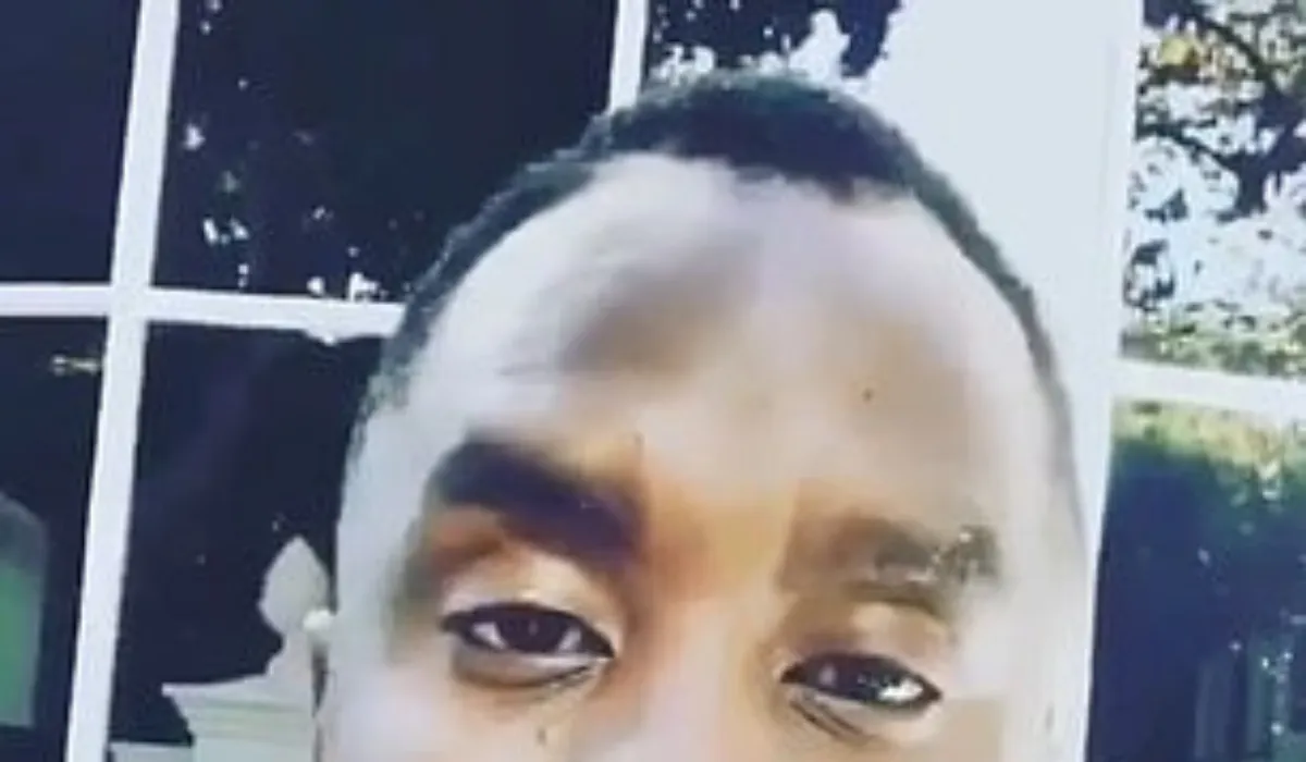 Diddy-Haartransplantatie-4 Diddy-Haartransplantatie-4