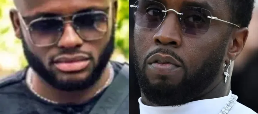 Diddy Hair Transplant