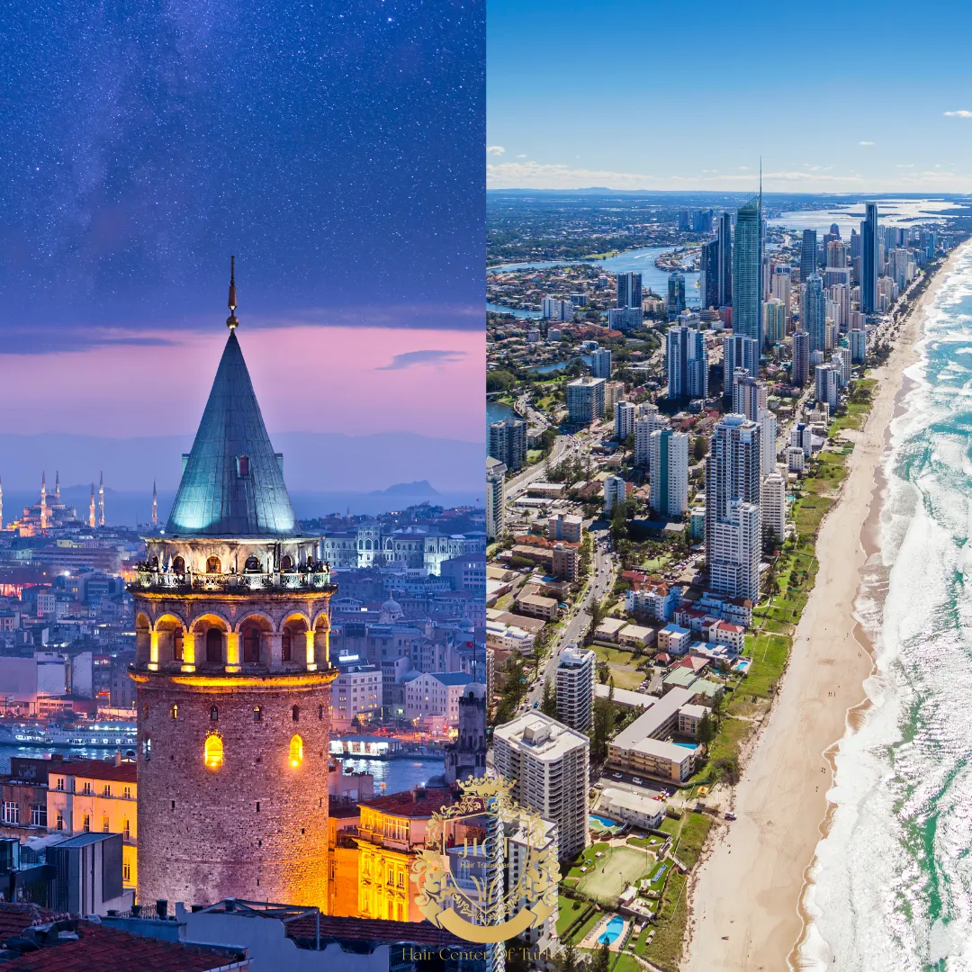 Trasplante Capilar Australia vs. Turquía 1 Trasplante Capilar Australia vs. Turquía