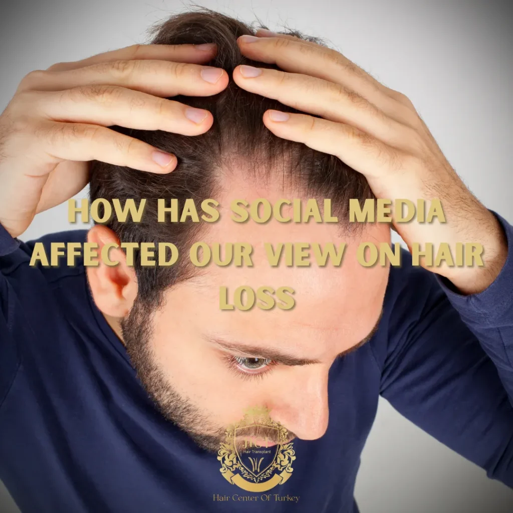 How Has Social Media Affected Our View on Hair Loss