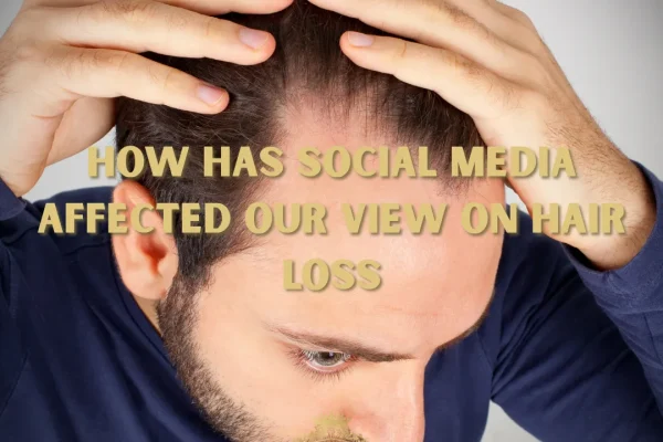De que forma as redes sociais afetaram nossa visão sobre a queda de cabelo?
