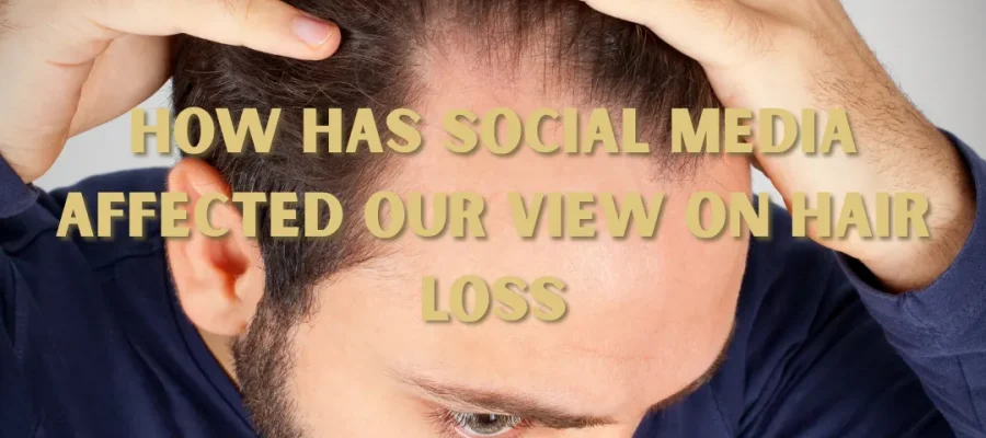 Comment les médias sociaux ont-ils influencé notre perception de la perte de cheveux ?