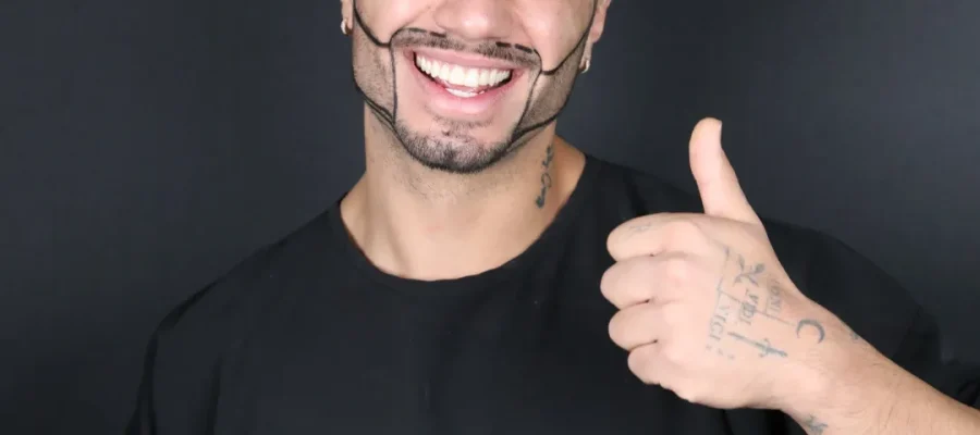 Wie zijn de ideale kandidaten voor een baardtransplantatie?