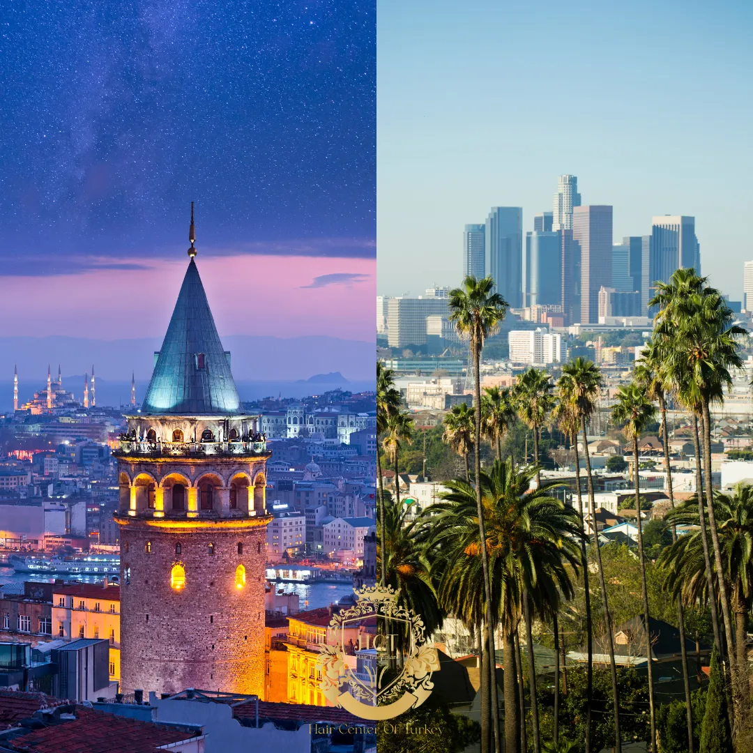 Is Los Angeles or Istanbul Better for a Hair Transplant F