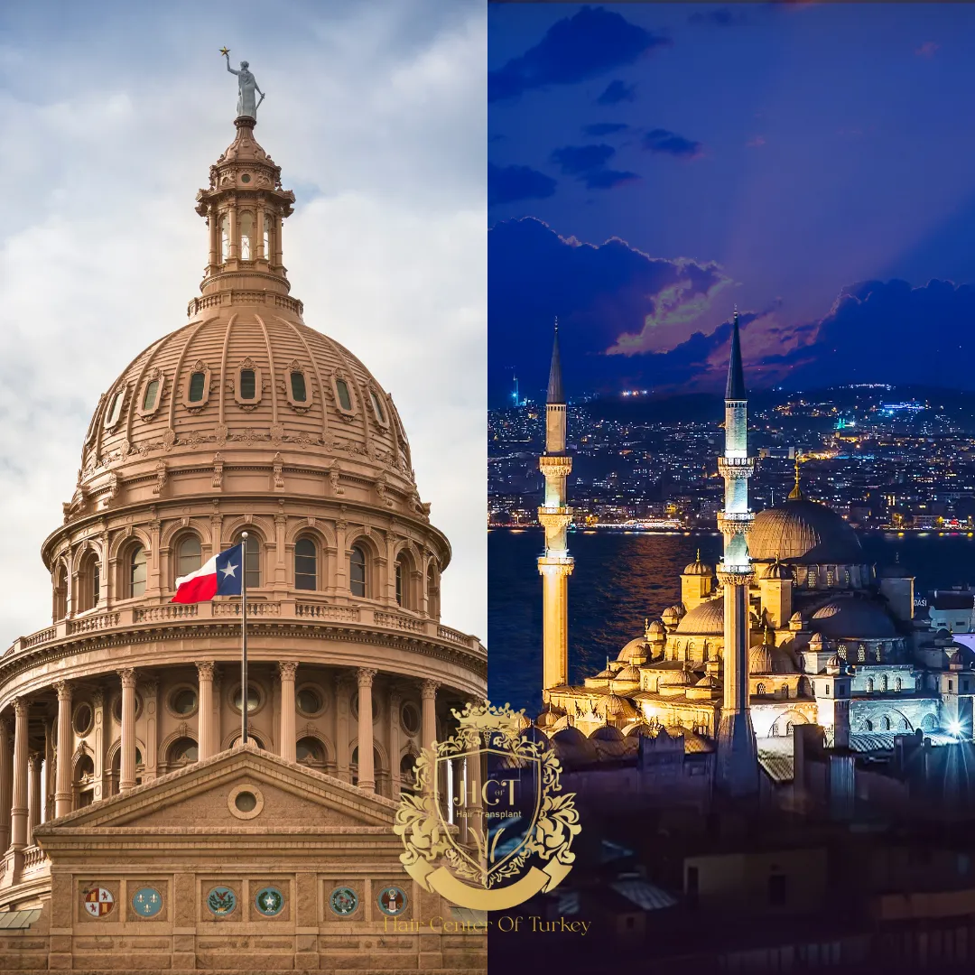 Is Texas or Istanbul Better for a Hair Transplant F