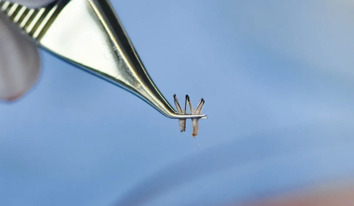 Jimmy Kimmel Haartransplantatie-7 Jimmy Kimmel Haartransplantatie-7