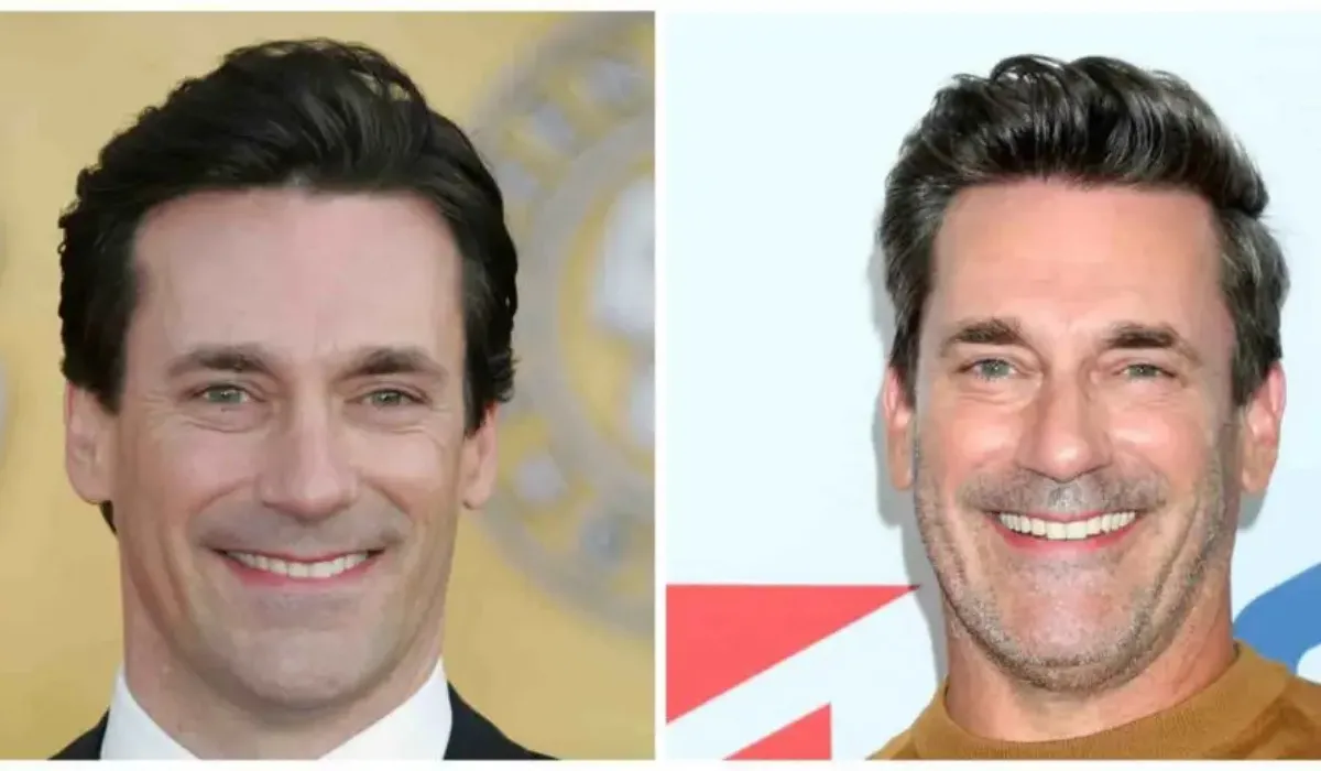 Jon Hamm – Haartransplantatie – 3 Jon Hamm - Haartransplantatie - 3