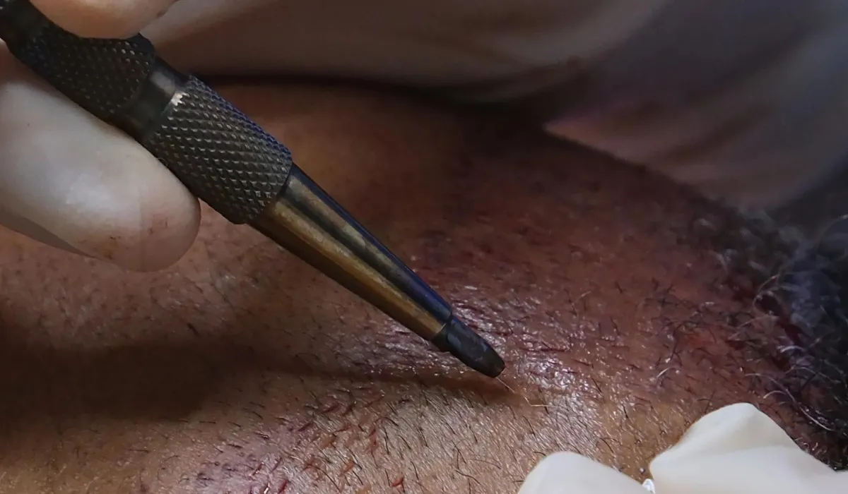 Jon Hamm haartransplantatie 6 Jon Hamm haartransplantatie 6