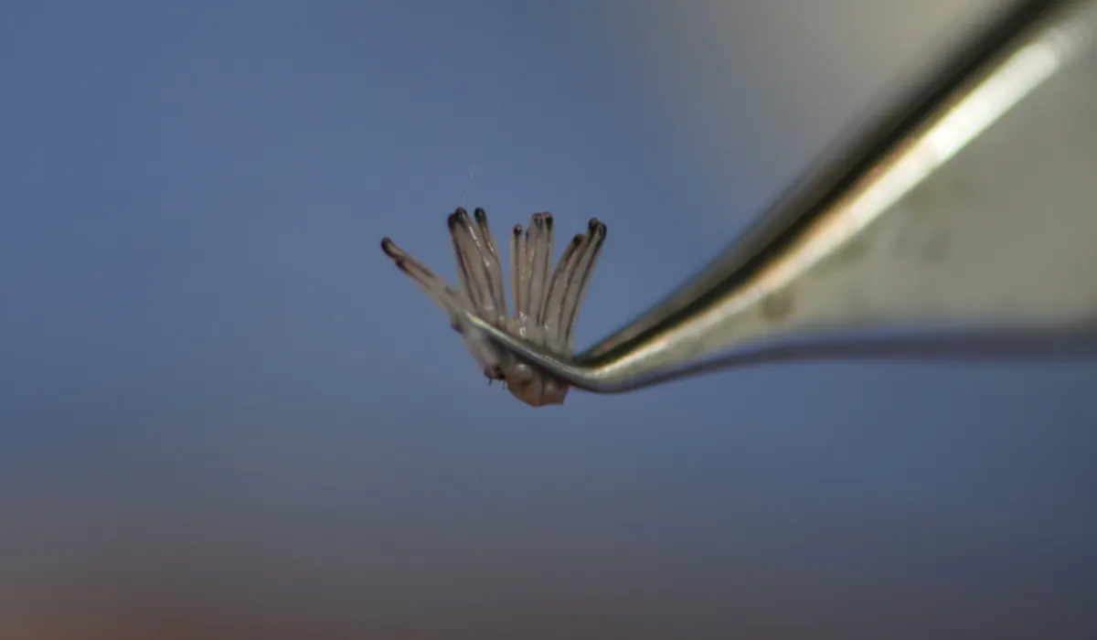 Mark Wahlberg haartransplantatie 7 Mark Wahlberg haartransplantatie 7