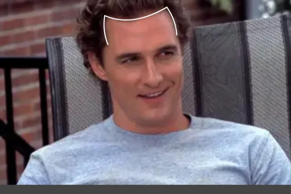 Matthew Mcconaughey Haartransplantation: Gerüchte, Regenix Und Was Plausibel Ist