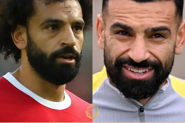 Mohamed Salah Haartransplantation