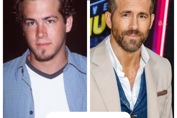 Ryan Reynolds Haartransplantation: Vorher-nachher-fotos, Gerüchte Und Was Dafür Nötig Sein Könnte