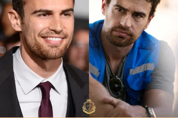 Theo James Haartransplantation