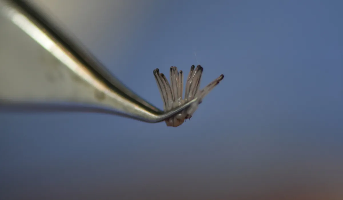 Timbaland-Haartransplantatie-8 Timbaland-Haartransplantatie-8