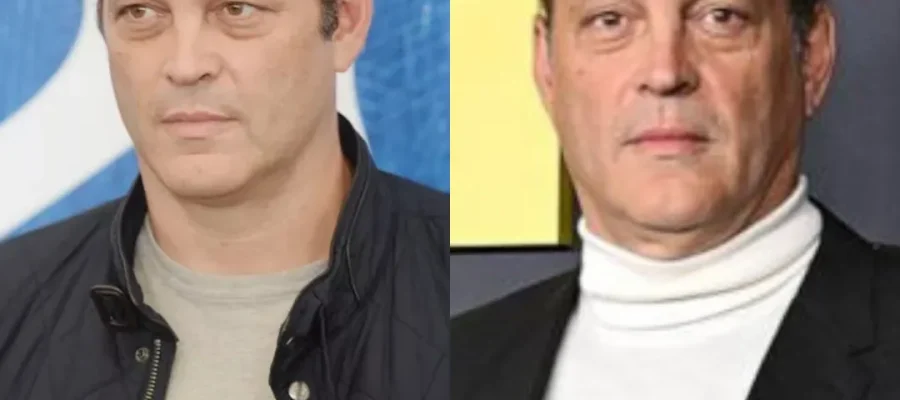 Vince Vaughn Hair Transplant