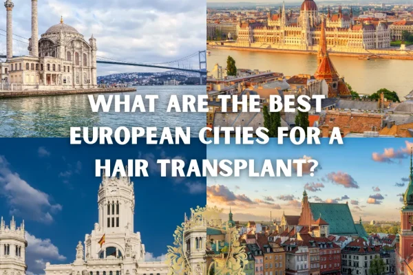 Was sind die besten europäischen Städte für eine Haartransplantation?
