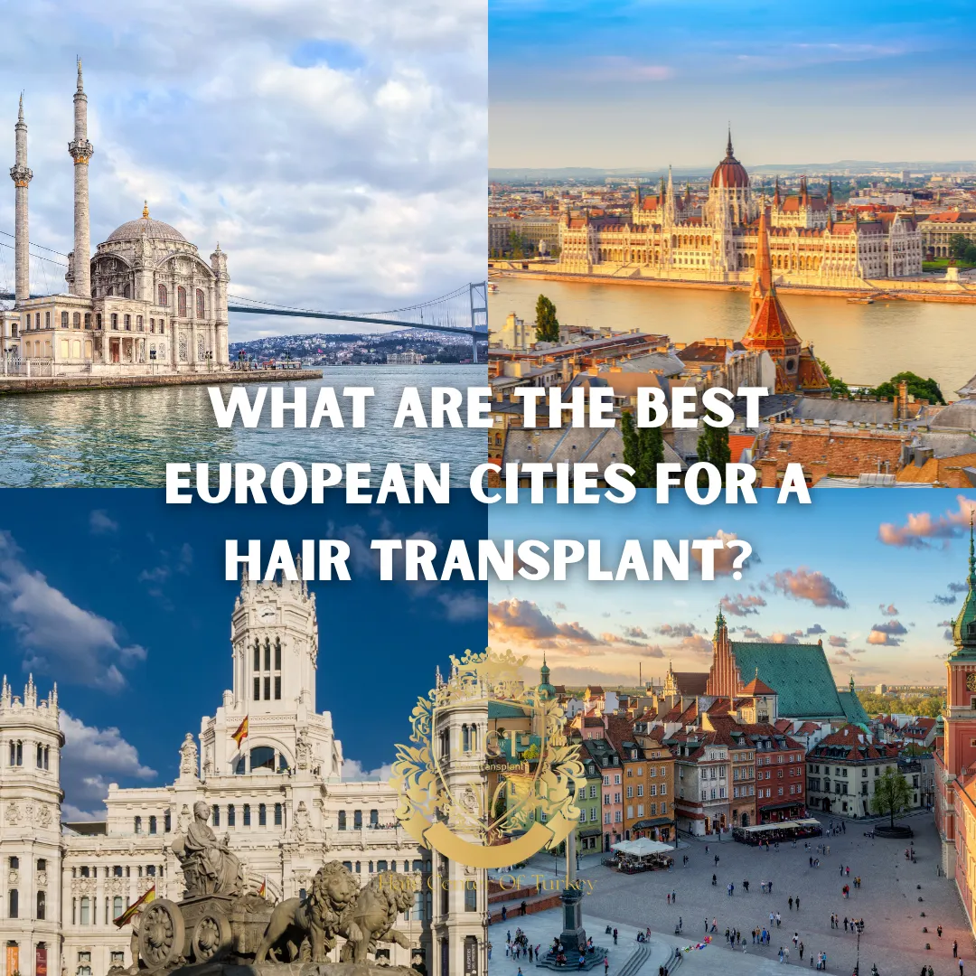 What Are the Best European Cities for a Hair Transplant F