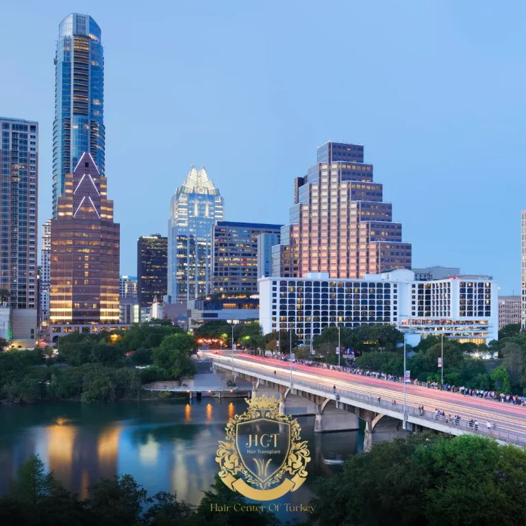 What Are the Best Hair Transplant Clinics in Austin F