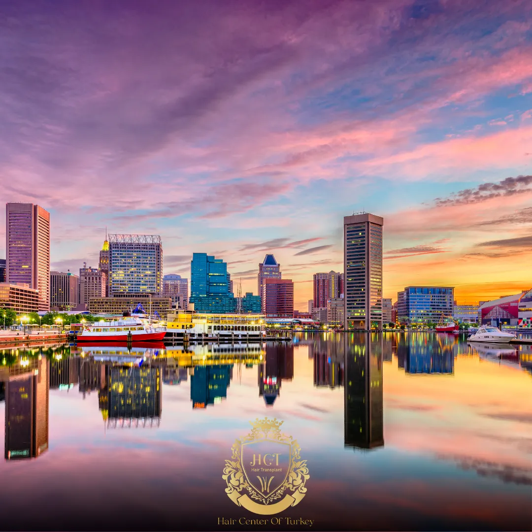 ¿Cuáles son las mejores clínicas de trasplante capilar en Baltimore? 1 What Are the Best Hair Transplant Clinics in Baltimore F