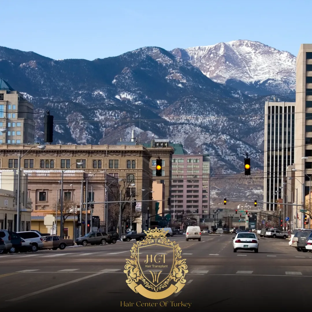 Wat zijn de beste haartransplantatieklinieken in Colorado Springs F