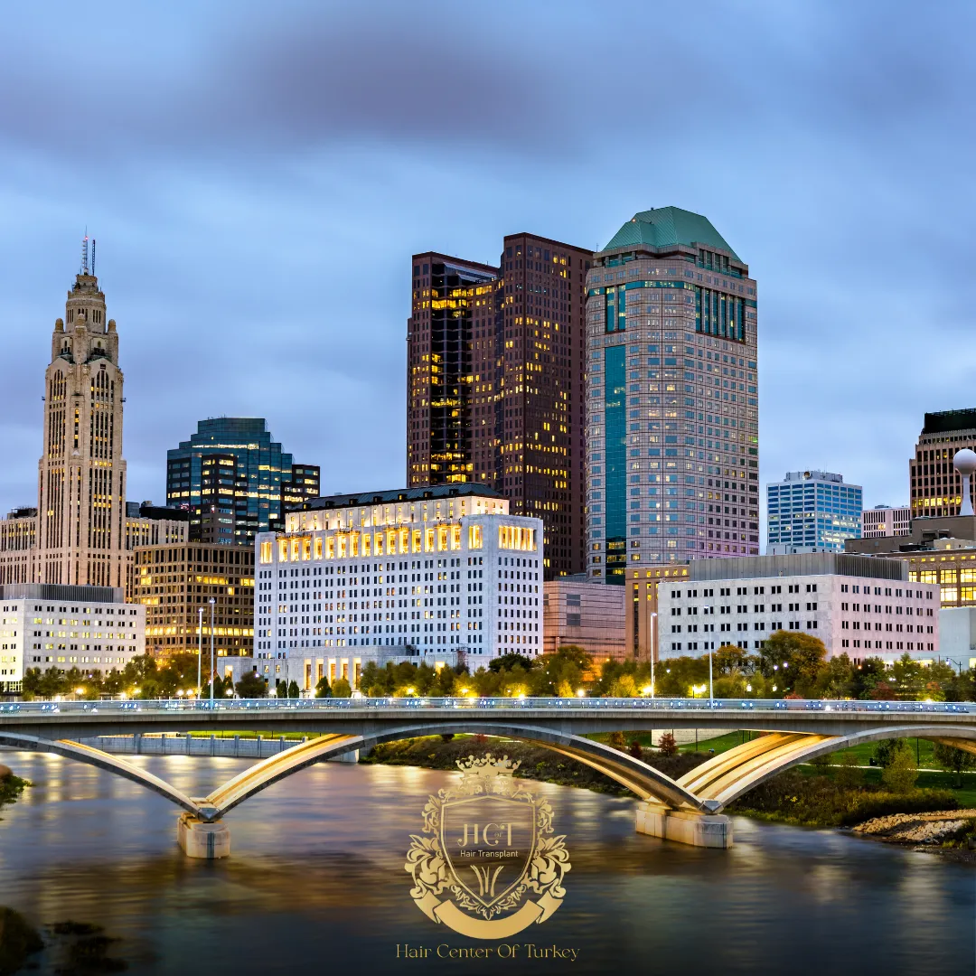 What Are the Best Hair Transplant Clinics in Columbus F