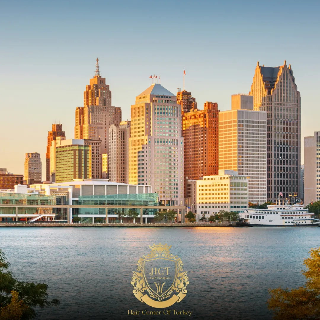 ¿Cuáles son las mejores clínicas de trasplante capilar en Detroit? 1 What Are the Best Hair Transplant Clinics in Detroit f
