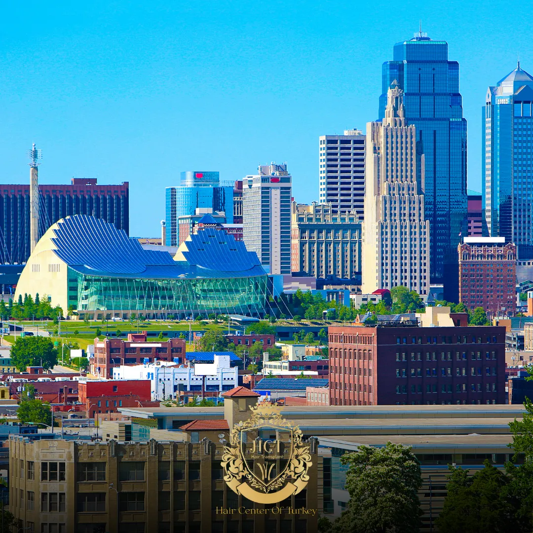 What Are the Best Hair Transplant Clinics in Kansas City F
