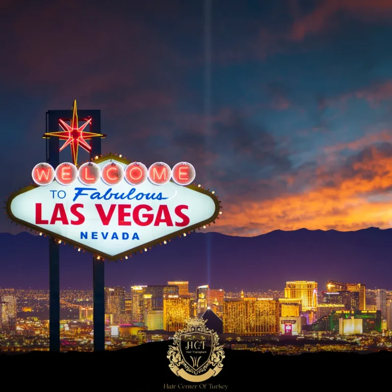 What Are the Best Hair Transplant Clinics in Las Vegas F