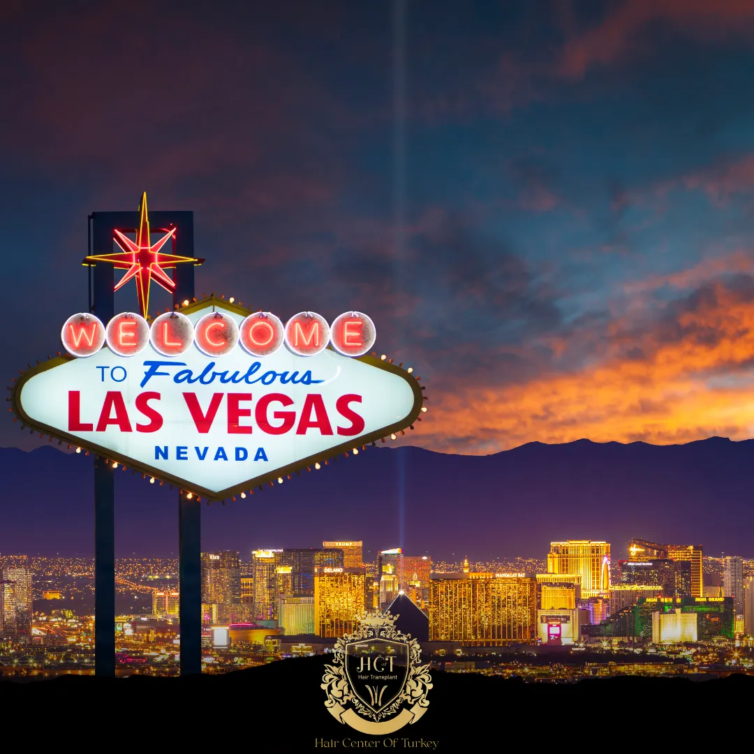 What Are the Best Hair Transplant Clinics in Las Vegas F