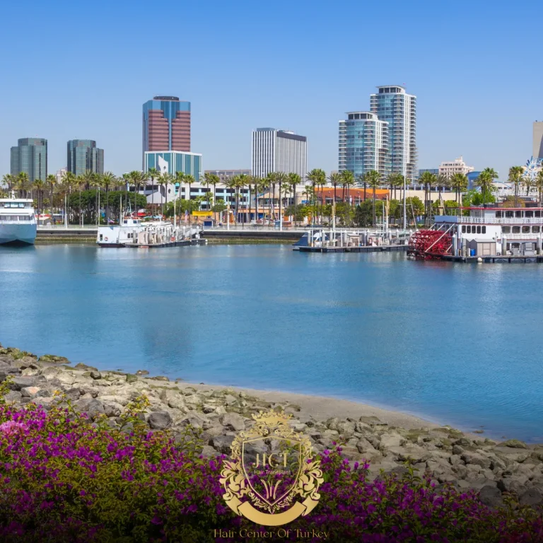 Wat zijn de beste haartransplantatieklinieken in Long Beach F