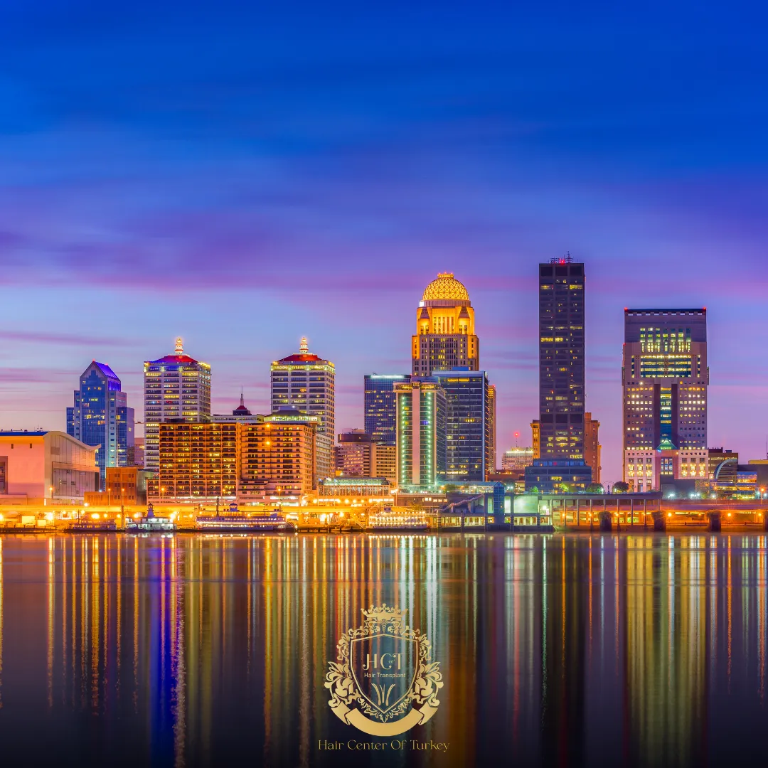 What Are the Best Hair Transplant Clinics in Louisville F