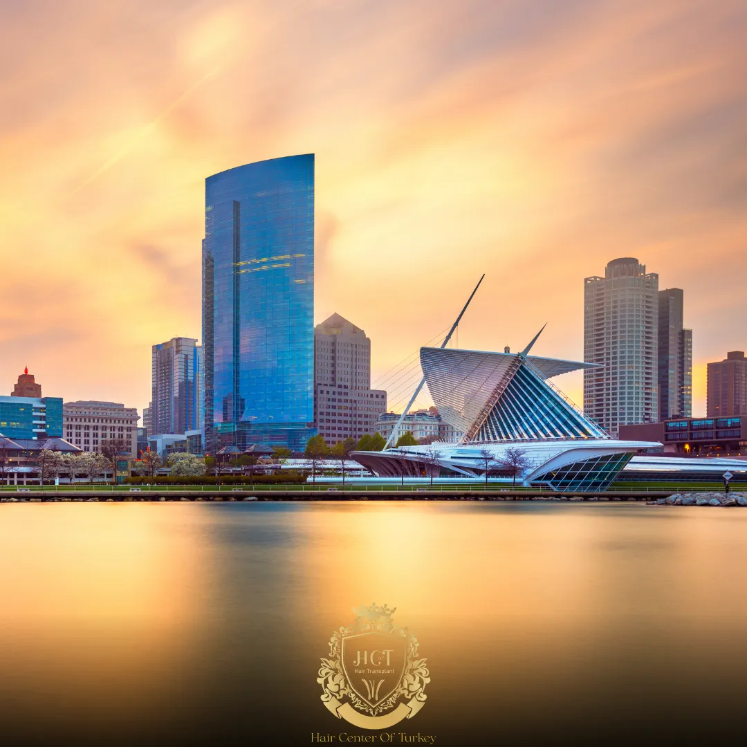 ¿Cuáles son las mejores clínicas de trasplante capilar en Milwaukee? 1 What Are the Best Hair Transplant Clinics in Milwaukee F