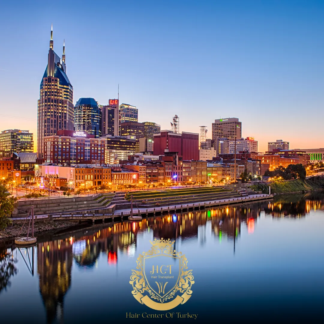 What Are the Best Hair Transplant Clinics in Nashville F